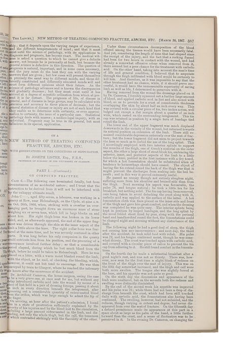 A New Method of Treating Compound Fracture, Abscess, etc. With Observations on the Conditions of Suppuration. Part I. On Compound Fracture - Part I (continued) - Part I (continued) - Part I (continued) - (Part II) New Method of Treating Compound Fract...
