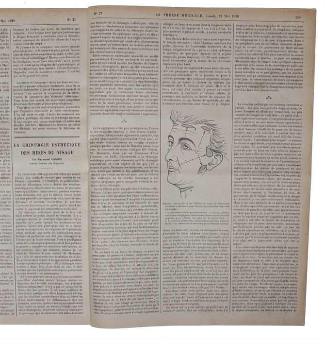 La Chirurgie Esthétique des Rides du Visage. [In: La Presse Médicale. No 27. Lundi, 12 Mai 1919].