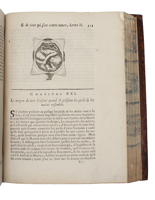 Traité des maladies des femmes grosses et de celles qui sont accouchées (...). Tome Premier (+) Observations sur la grossesse et l'accouchement des femmes et sur leurs maladies et celles des enfans nouveau-nés en chacune desquelles les causes et les ...